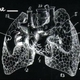 Between Two Lungs