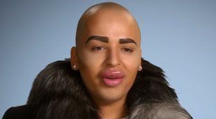 Las operaciones más escandalosas y extremas vistas en programas de televisión