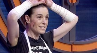 'MasterChef Celebrity 5': Raquel Sánchez Silva acaba con los brazos vendados tras un accidente