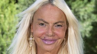 La última cirugía plástica de Leticia Sabater para recuperar su mirada