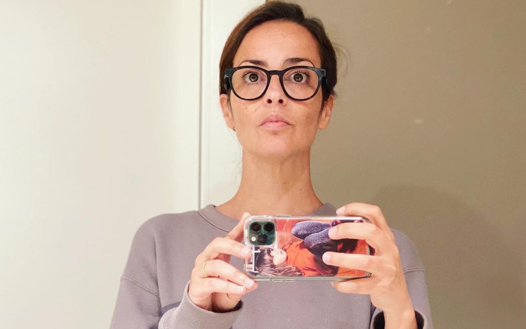 Vega padece alopecia a causa del coronavirus: "No me asusta, ya me vi rapada al cero por voluntad"