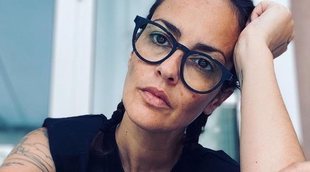 Vega padece alopecia a causa del coronavirus: "No me asusta, ya me vi rapada al cero por voluntad"