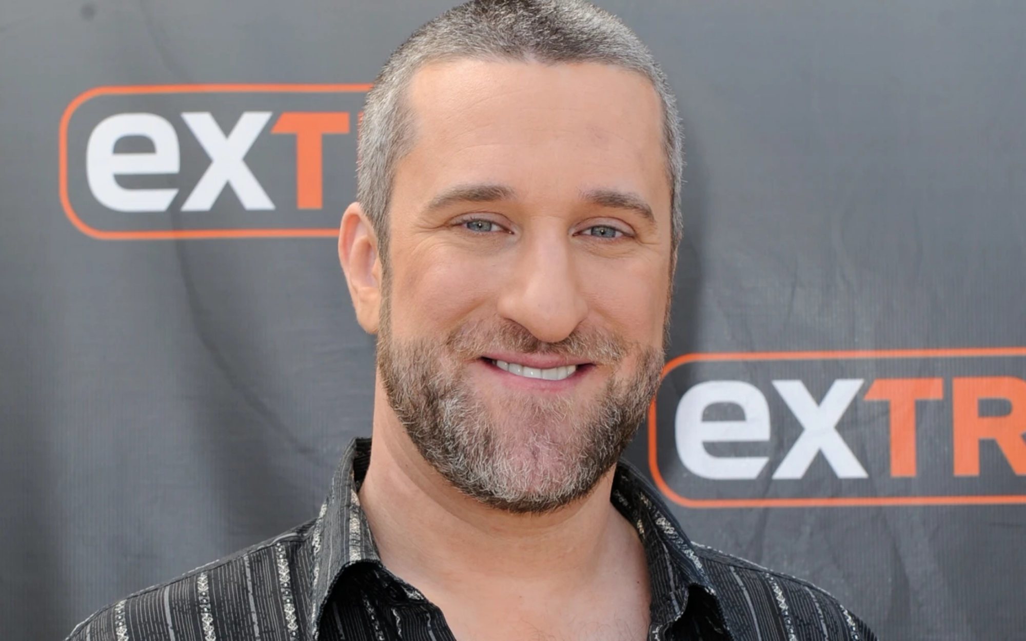 Dustin Diamond ('Salvados por la campana') confirma que padece cáncer