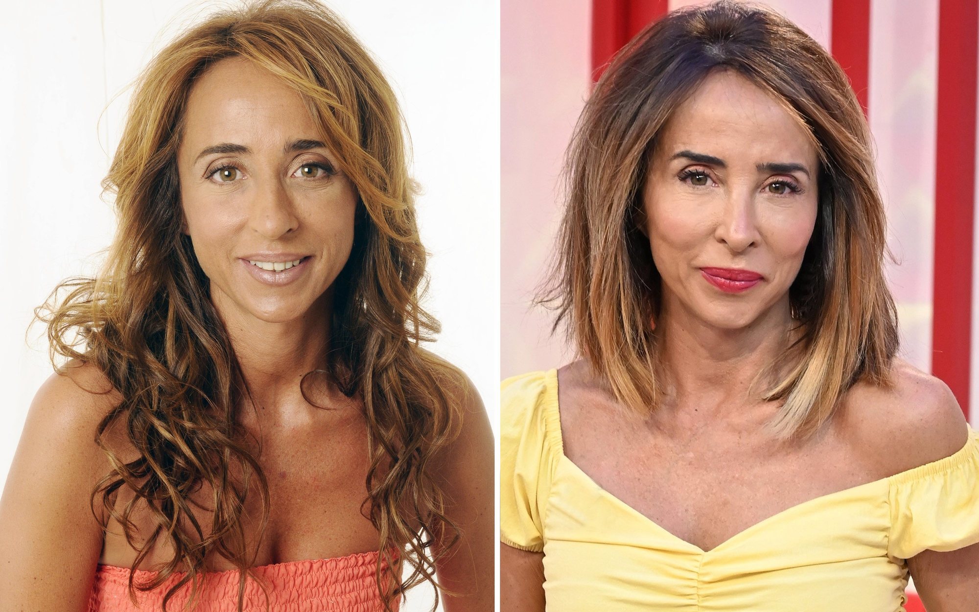 El dineral que se habría gastado María Patiño en retoques estéticos en los últimos 21 años