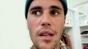 Justin Bieber cancela parte de su gira por una parálisis facial causada por un virus