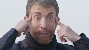 Pablo Motos y su drama con el bótox tras romperse los dientes y salir mal su operación de vista