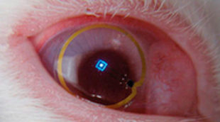 Investigadores desarrollan unas lentillas con televisión incorporada