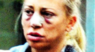 Belén Esteban se opera de nuevo la nariz y el pecho