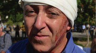 Jeremy Bowen, periodista de BBC, herido por un disparo en Egipto