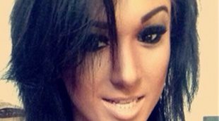 Una modelo, a punto de morir por intentar parecerse a Kim Kardashian