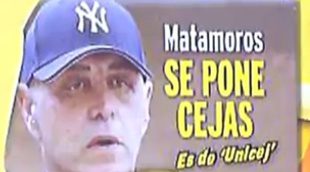 Kiko Matamoros vuelve a recurrir al quirófano, esta vez para ponerse cejas