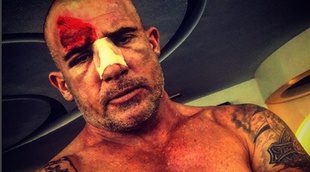 Brutal accidente de Dominic Purcell en el rodaje de la nueva temporada de 'Prison Break'