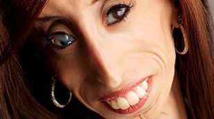 Lizzy, la mujer más fea del mundo, protagonista del primer episodio de 'Diagnósticos extraordinarios'