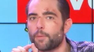 Dani Mateo explica la surrealista historia de por qué tiene la cara llena de heridas
