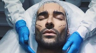 Miguel ('GH 17') se somete a una operación estética para rentabilizar su estilo de vida