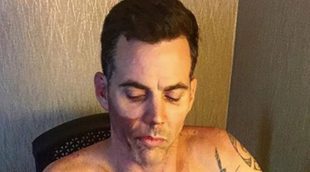 Steve-O, de 'Jackass', se quema la piel con un bidón de gasolina