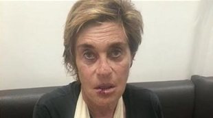 'Sálvame': Chelo García Cortés desata la ira de sus compañeros al ser pillada sin el cabestrillo