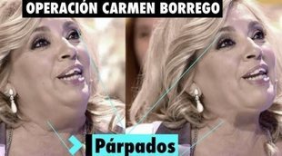 La reducción de papada y de párpados de Carmen Borrego habría costado 3.000 euros
