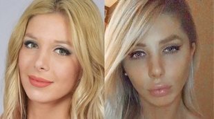 Romina Malaspina ('Supervivientes'), irreconocible tras someterse a varias operaciones estéticas