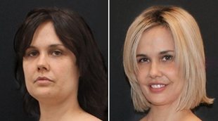 El cambio radical de Miriam Sánchez tras pasar por quirófano: "Dejé de escuchar peña que me toca tol coño"