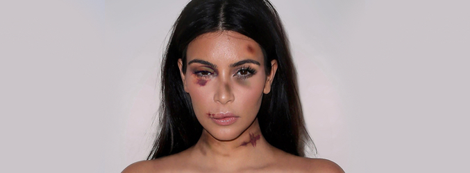 Kim Kardashian golpeada para 
