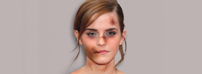 Emma Watson golpeada para "Break the silence