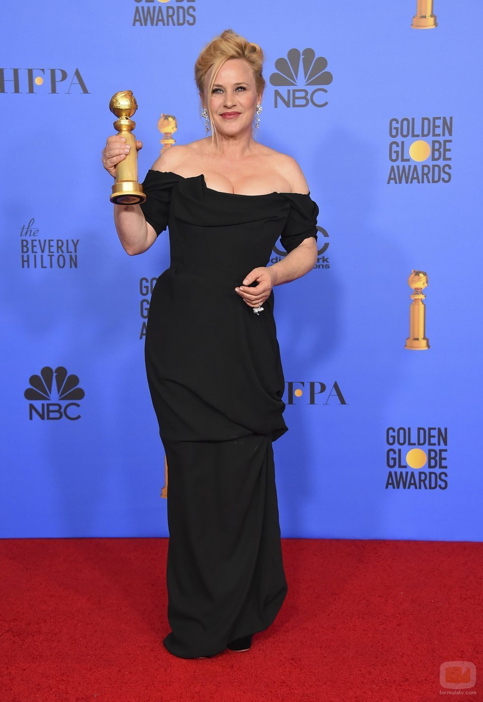 Patricia Arquette, ganadora del Globo de Oro 2019 a Mejor Actriz de Miniserie o TV Movie