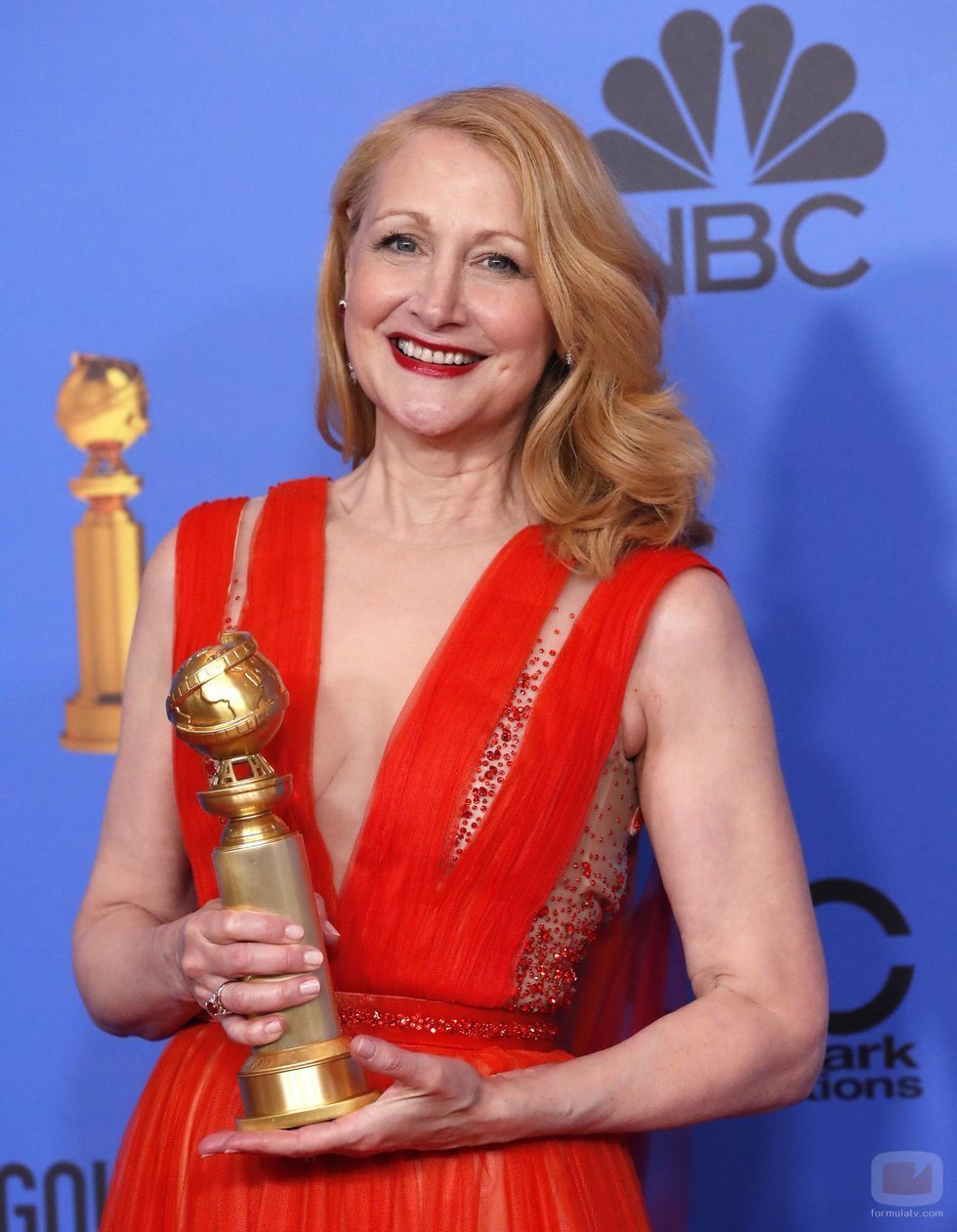 Patricia Clarkson, ganadora del Globo de Oro a Mejor Actriz Secundaria