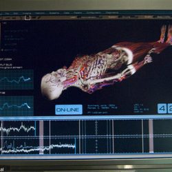 Escena del piloto de Bionic Woman