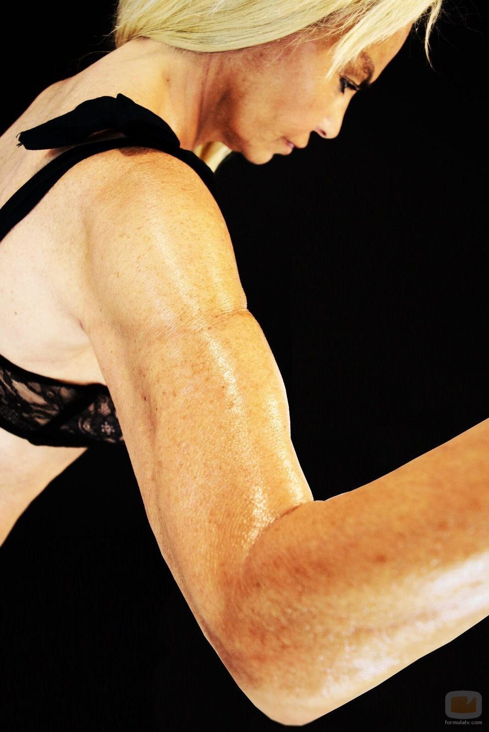 El musculado brazo de Leticia Sabater tras su operación
