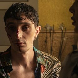 Angelo (Ciro Petrone), herido en el 1x06 de 'Veneno'