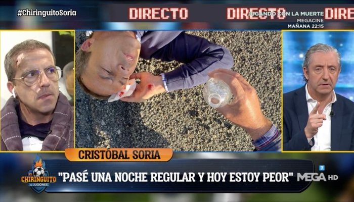 Cristóbal Soria recuerda su accidente en 'El Chiringuito'