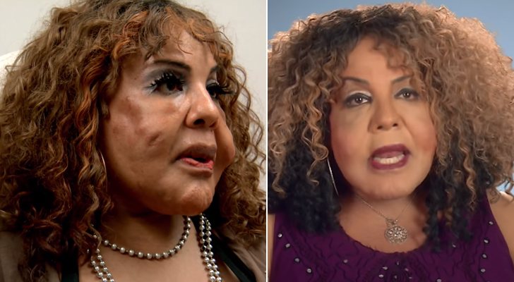 Rajee antes y después de la intervención en 'Chapuzas estéticas'