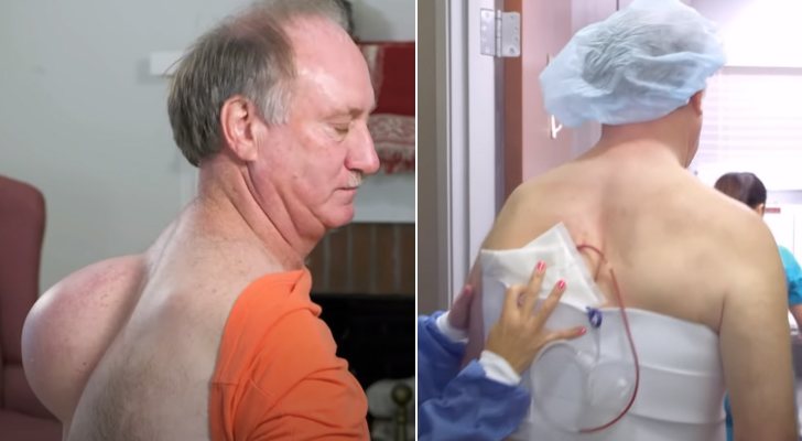 Tim antes y después de la operación en 'La doctora Lee'