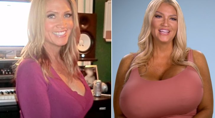 Allegra antes y después de su aumento de pechos en 'Chapuzas estéticas'