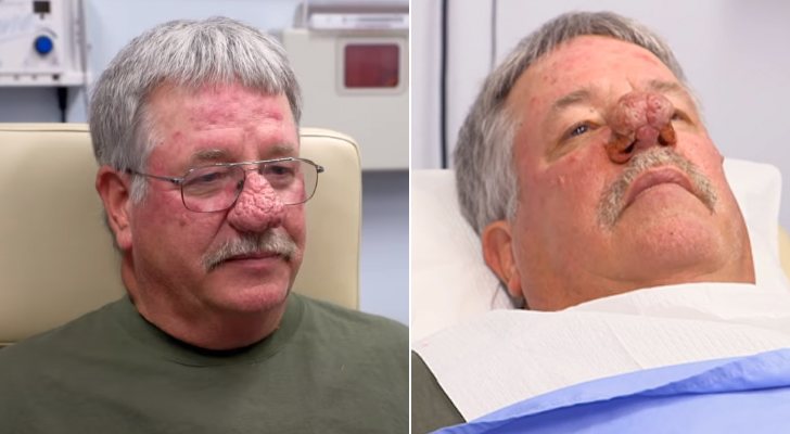 Patrick antes y después de la intervención en 'La doctora Lee'