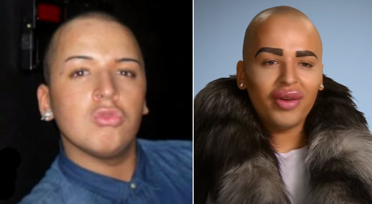 Jordan antes y después de sus operaciones en 'Chapuzas estéticas'