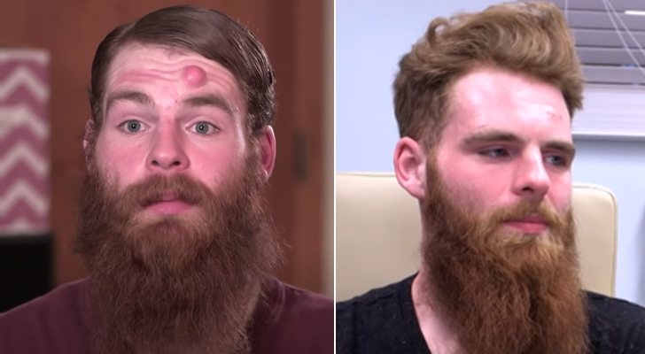 Justin antes y después de la intervención en 'La doctora Lee'