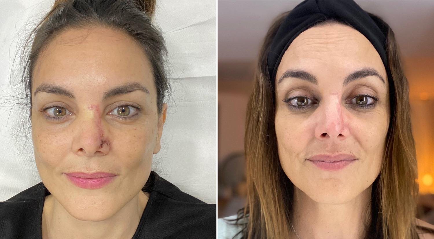 Evolución del rostro de Mónica Carrillo, compartido por ella en redes