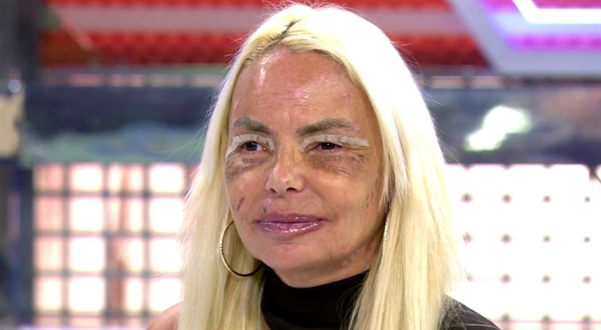 Leticia Sabater muestra los resultados de su operación en 'Sábado deluxe'