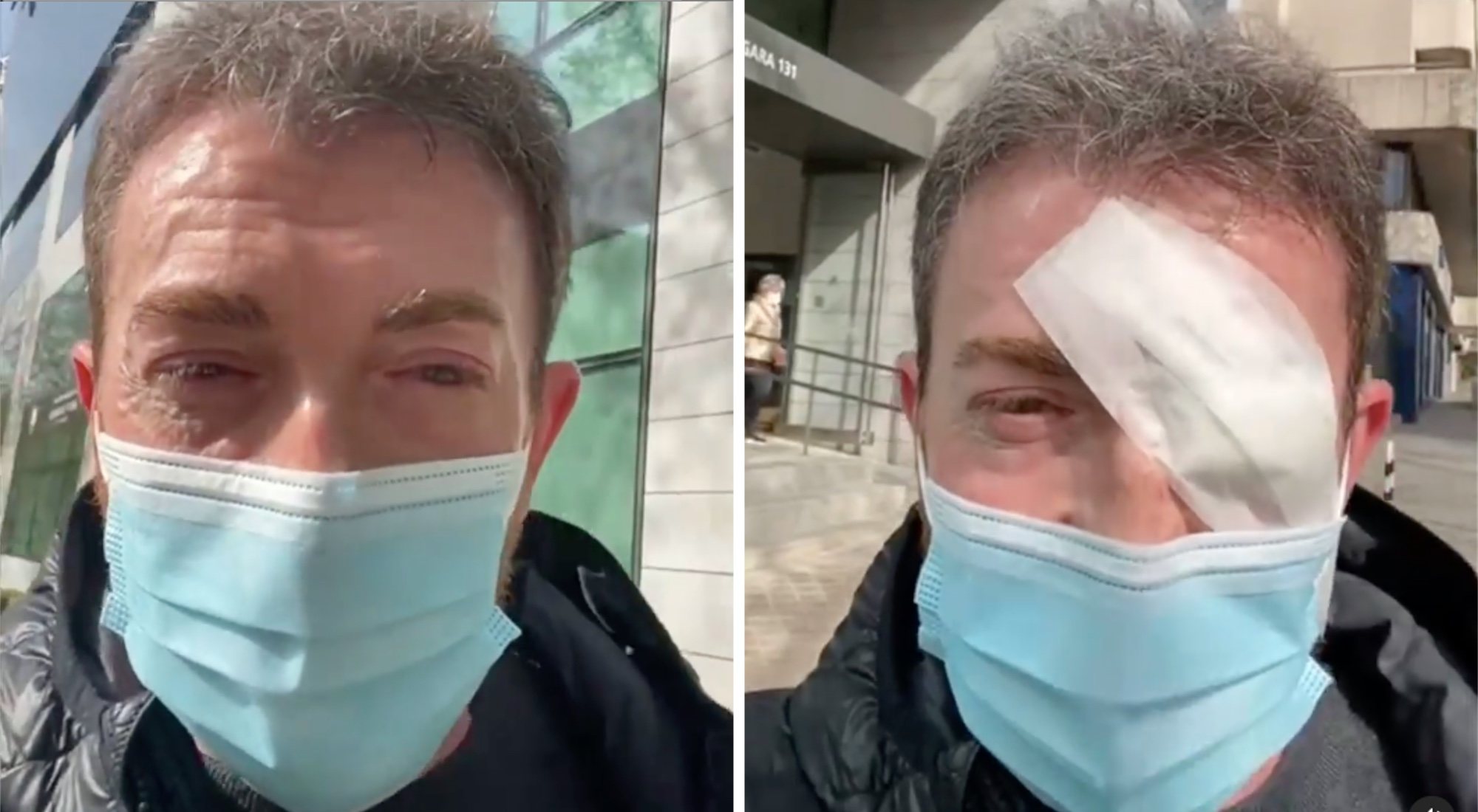 Antes y después de la operación de Pablo Motos