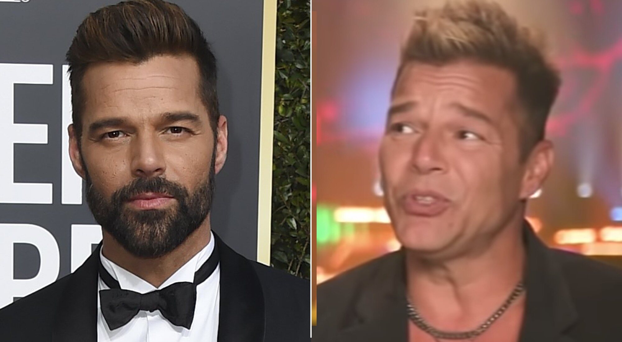 Ricky Martin, antes y después de su retoque estético
