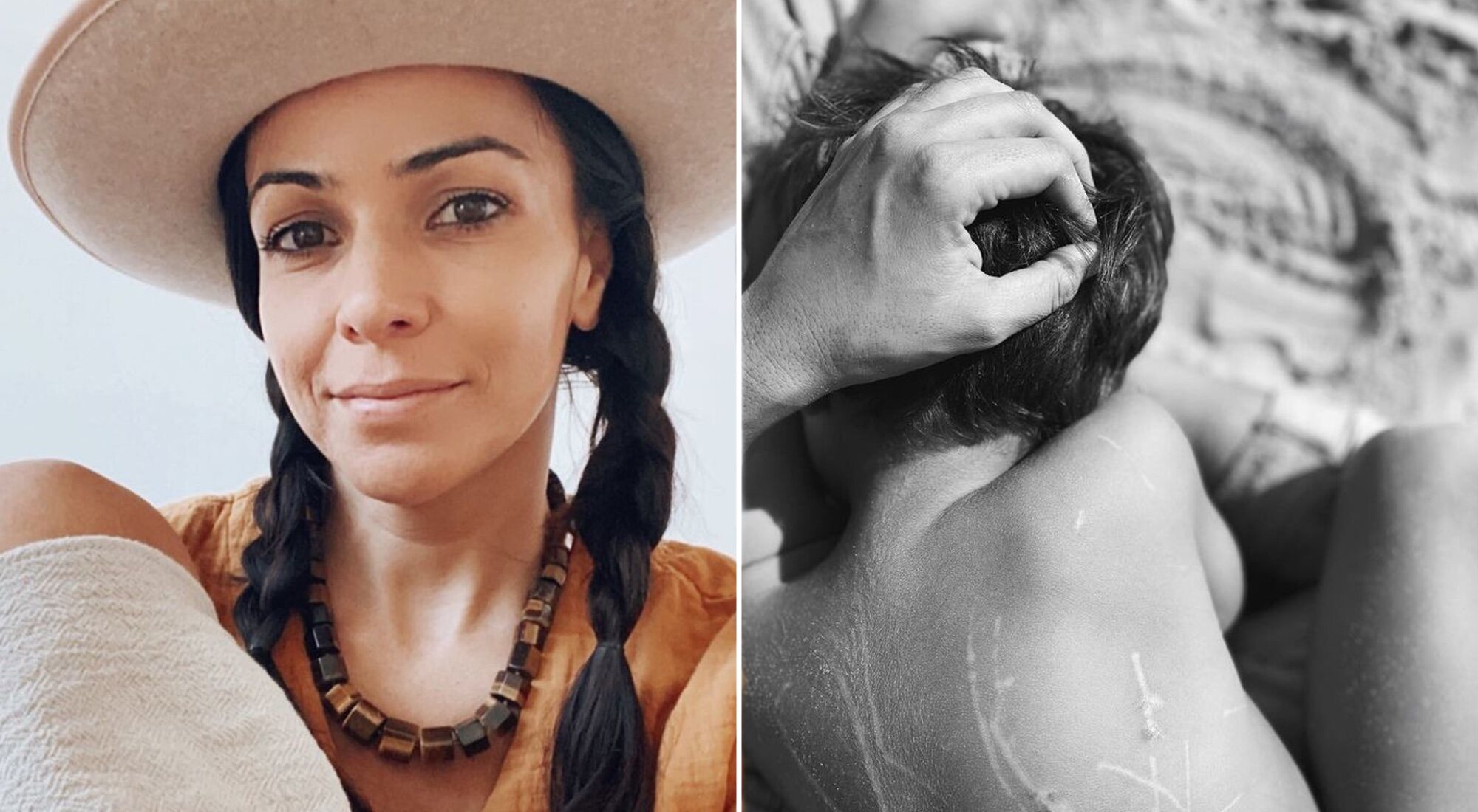 Raquel del Rosario y las cicatrices de su hijo provocadas por el ataque del puma