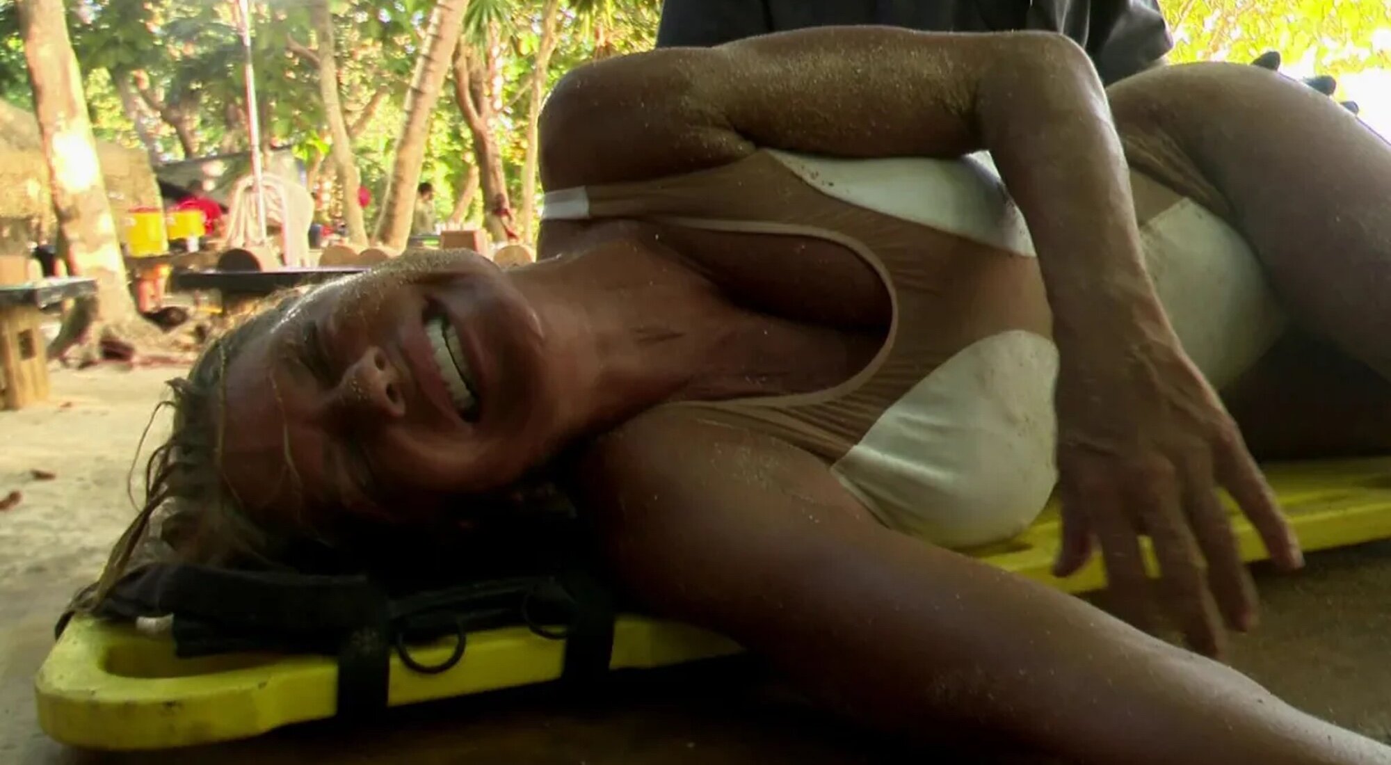 Makoke tras su grave caída en 'Supervivientes 2025'