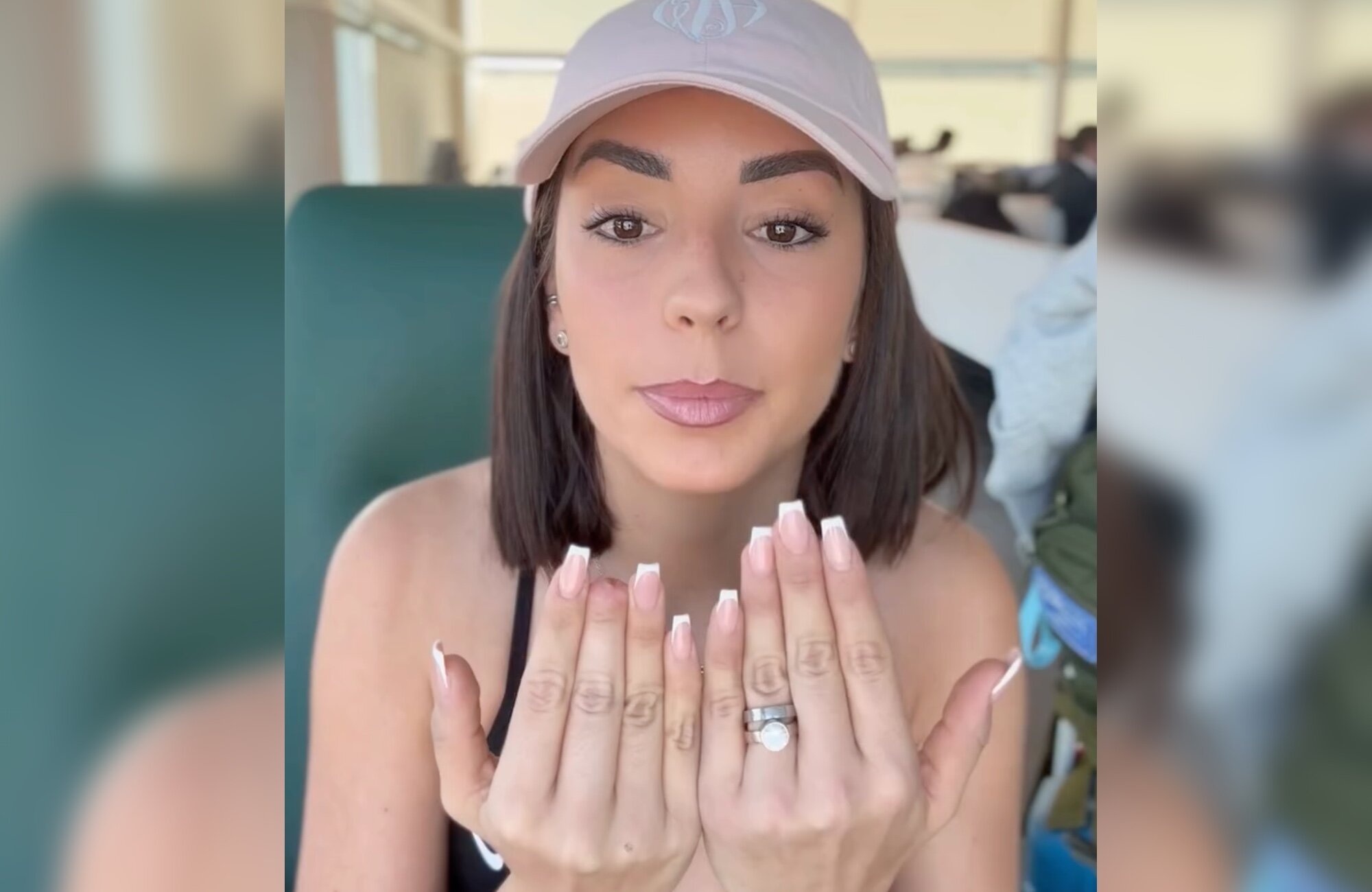 Anita Williams muestra el resultado de su dedo tras su accidente en 'GH Dúo'