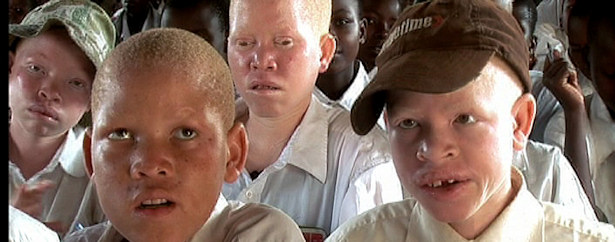 Un grupo de niños albinos de una imagen de un documental de TVE