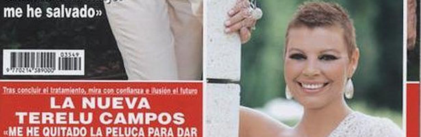 Terelu Campos sin peluca