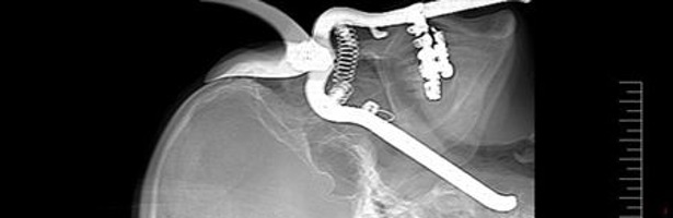 'Urgencias punzantes'