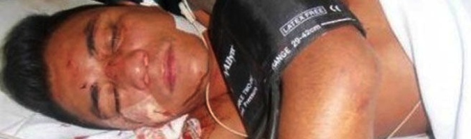 El actor Mauricio Bastidas ingresado en el hospital