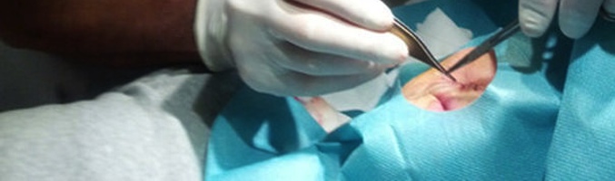 Mercedes Milá durante su intervención quirúrgica. Foto: Telecinco